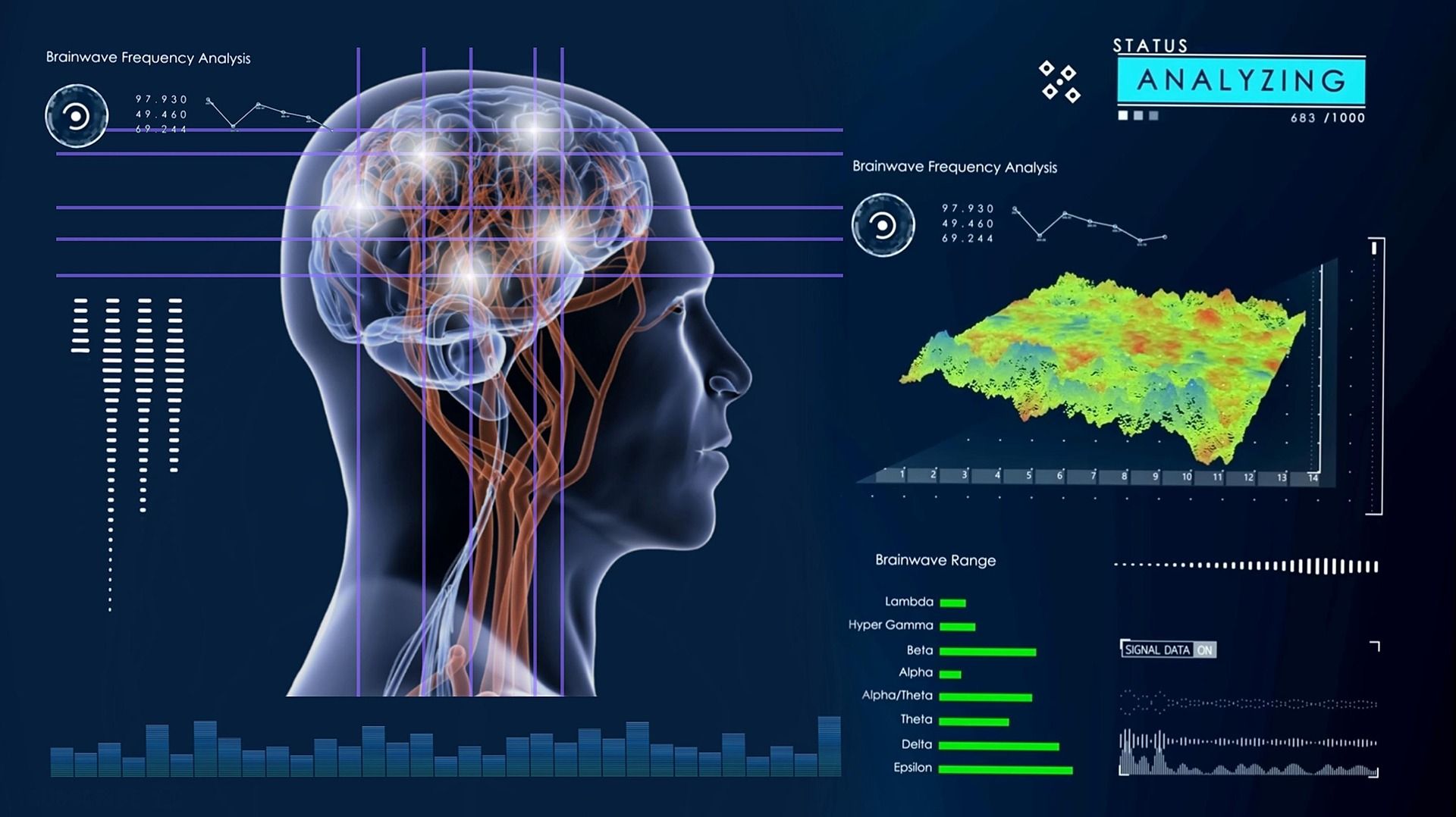 Ilustración del cerebro y gráficos de análisis de frecuencias de ondas cerebrales